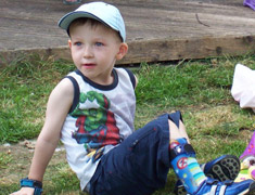 Child sitting in the grass with a leg brace