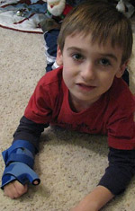 Hand Splints