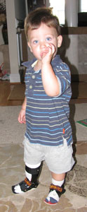 Boy with Two Leg Braces