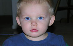 Early Intervention