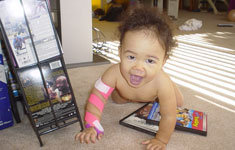 Baby with arm brace