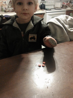 Constraint-Induced-Movement-Therapy-Child With Hemiplegia Cerebral Palsy